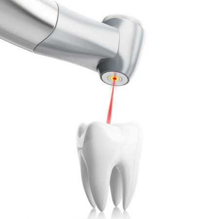 stomatolog-apolonija-zagreb-centar-3d-ilustracija-stomatološkog-lasera