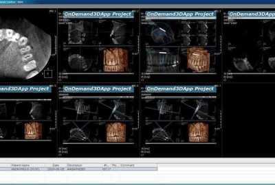 slika-3D-CBCT-snimke