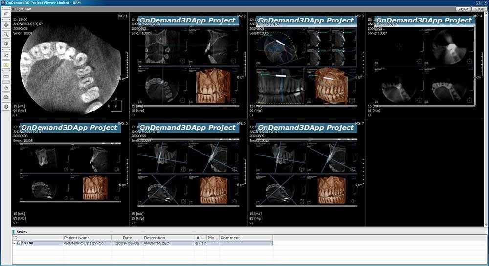 slika-3D-CBCT-snimke