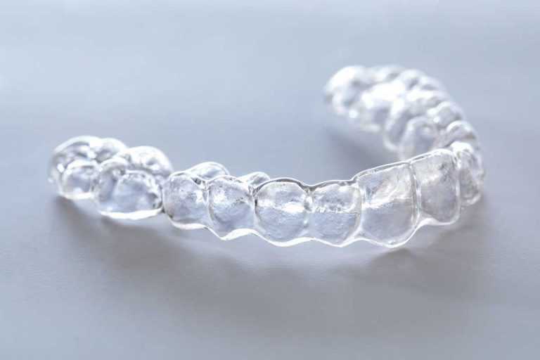 Stomatološka poliklinika Apolonija, Zagreb, centar: prozirna Invisalign folija.