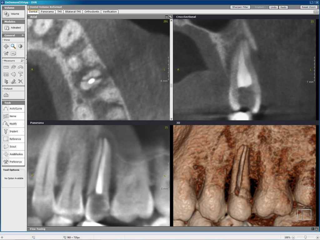 Stomatološka poliklinika Apolonija, Zagreb centar: 3D snimka zubi, tvrdog i mekog tkiva.