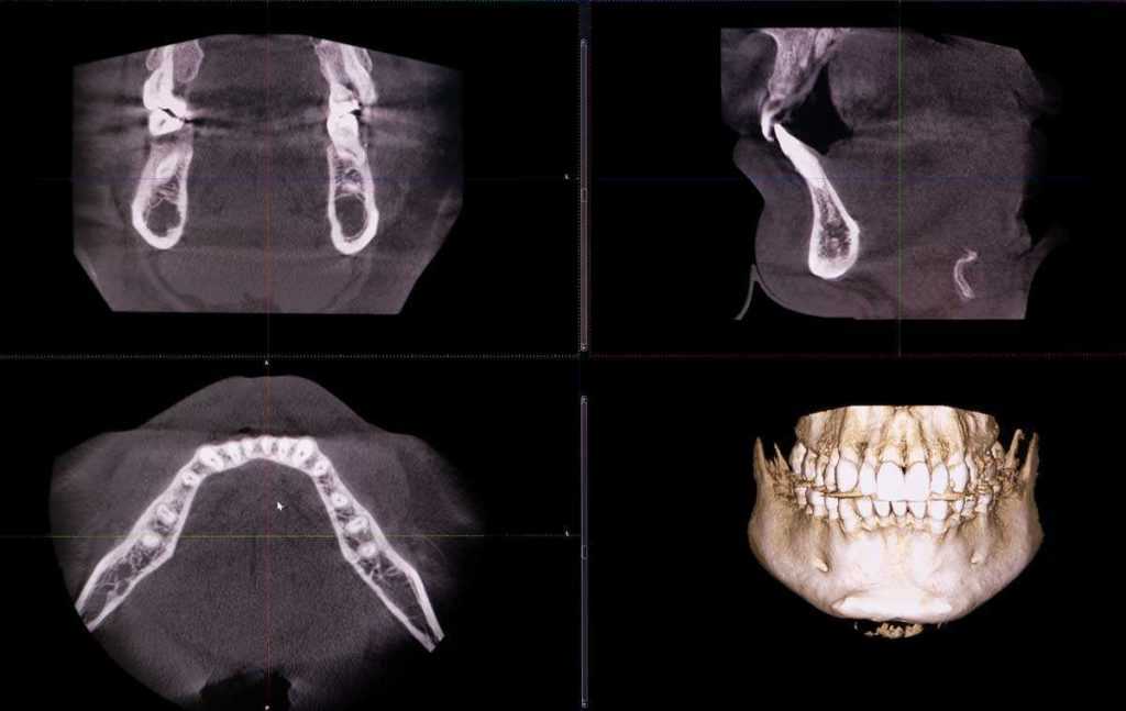 Stomatološka poliklinika Apolonija, Zagreb centar: ortopanski i 3D CBCT snimak.